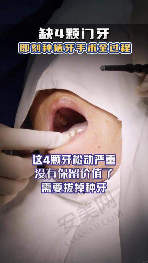 上海松丰齿科的医生团队和服务如何？