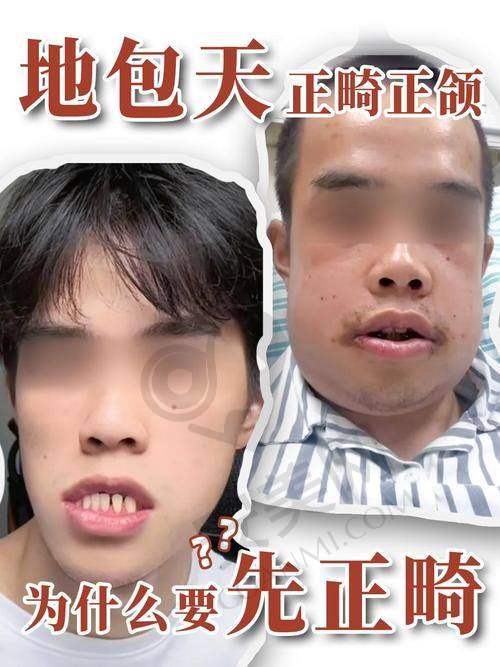 复诊：复诊的频率和作用是什么？