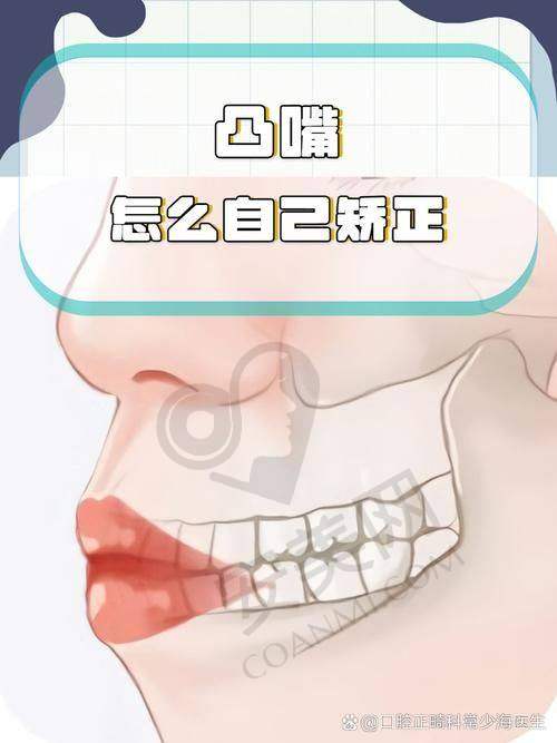 凸嘴矫正2W元起的价格合理吗？