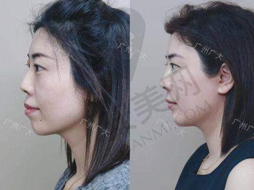 苏州美奥口腔医院的医生团队如何？
