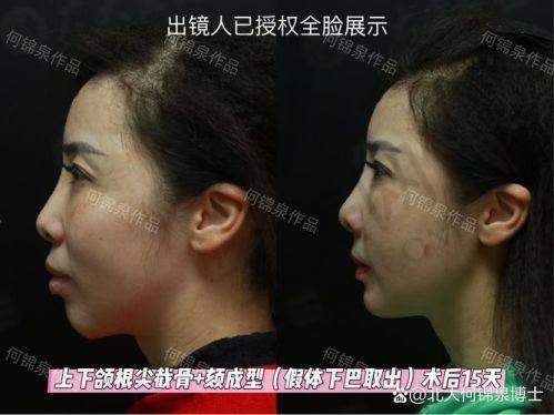 苏州美奥口腔医院是怎样的医院？