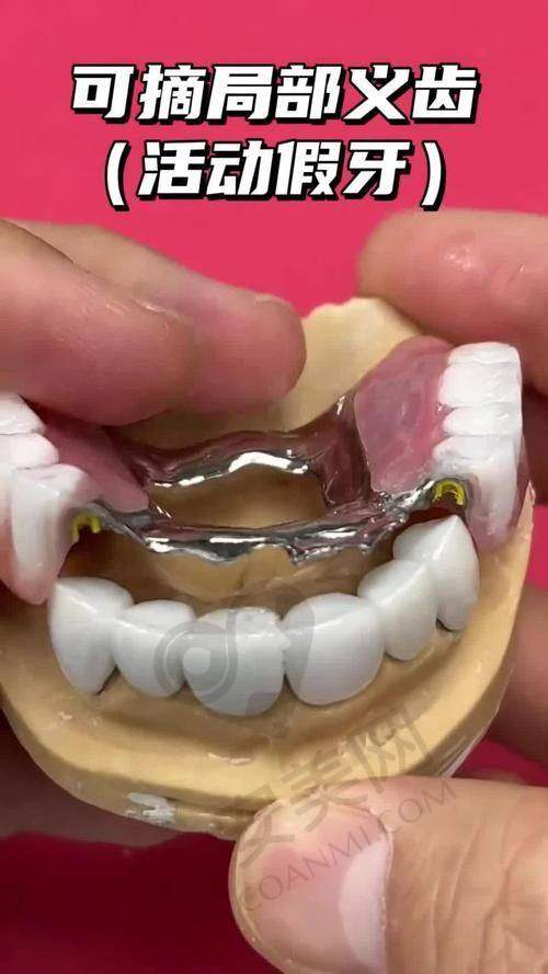 佩戴全口活动假牙后需要注意什么？