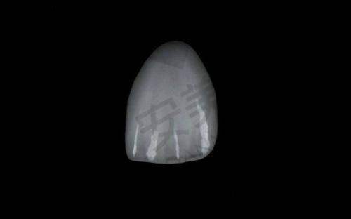 哪些人适合达州医大口腔医院的牙齿贴面美白？