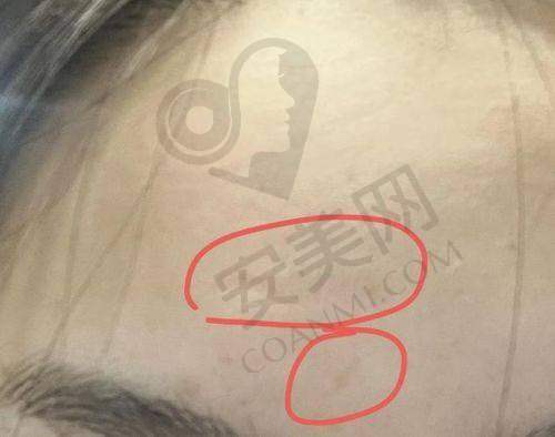 武汉正璞张炳生医生预约挂号指南