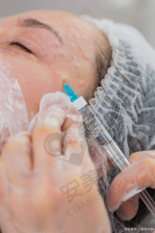 为我注射的医生技术如何？