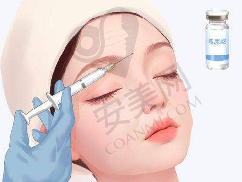 常见疑问解答