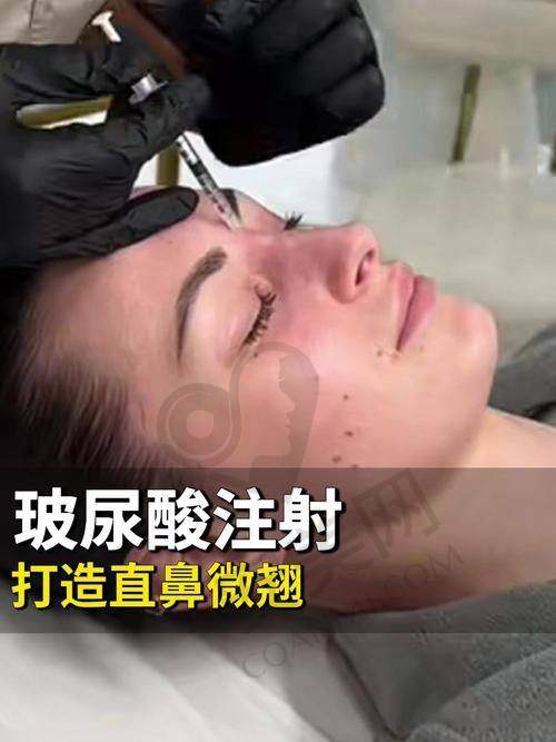 玻尿酸注射塑形，究竟能为你带来什么改变？