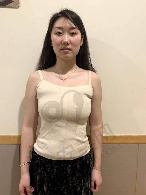 武汉仁爱时光脂肪隆胸，技术特色在哪？