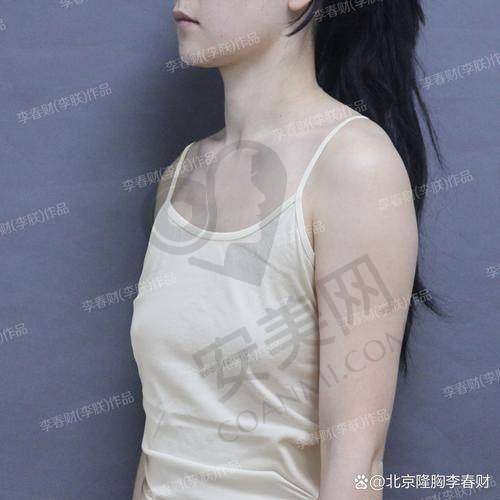 武汉仁爱时光脂肪隆胸，术后护理重要吗？