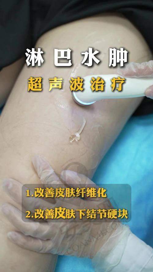 美莱整形——超声炮治疗的理想之选