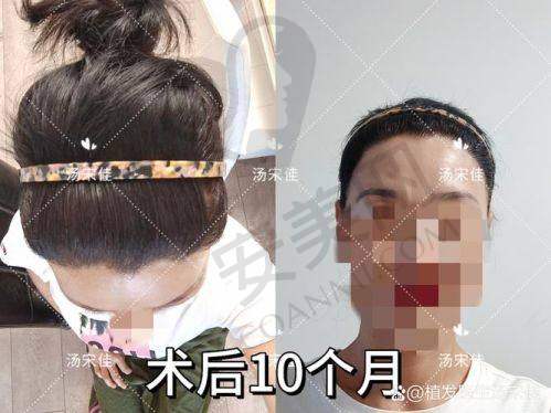 成都大麦医院的医生团队怎么样？
