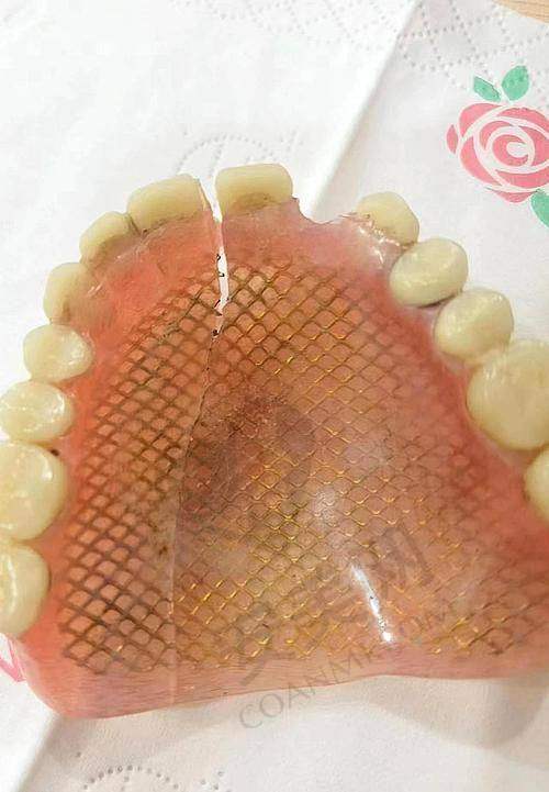北京维乐口腔的售后服务怎么样？