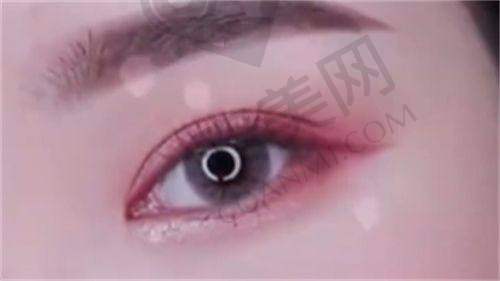 孙劲劲医生的手术风格有什么特点？