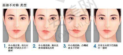 吸脂塑形价格一览