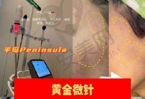 上海虹桥疤痕医院的环境设施如何？