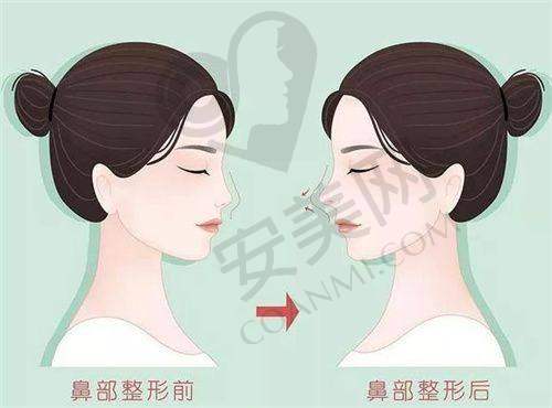 轮廓整形价格详情