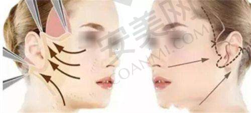 西安画美医院收费价格公示