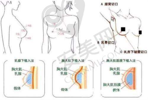 海口优质整形医院盘点