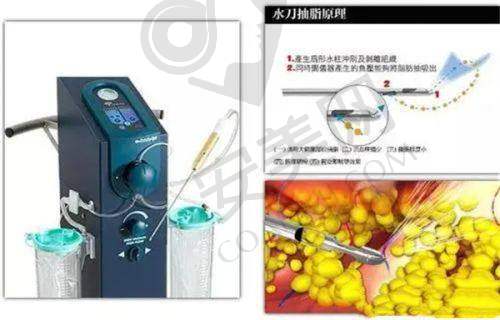 技术难度与医生要求对比