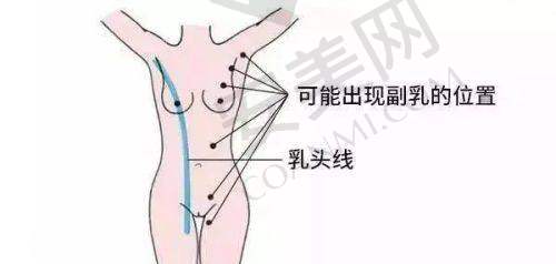 SMAS除皱术与常规除皱术的原理剖析
