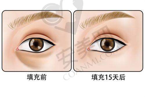 1、洛阳莱尔美刘战辉医生怎么样？