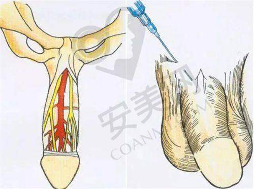 治疗过程是怎样的体验？