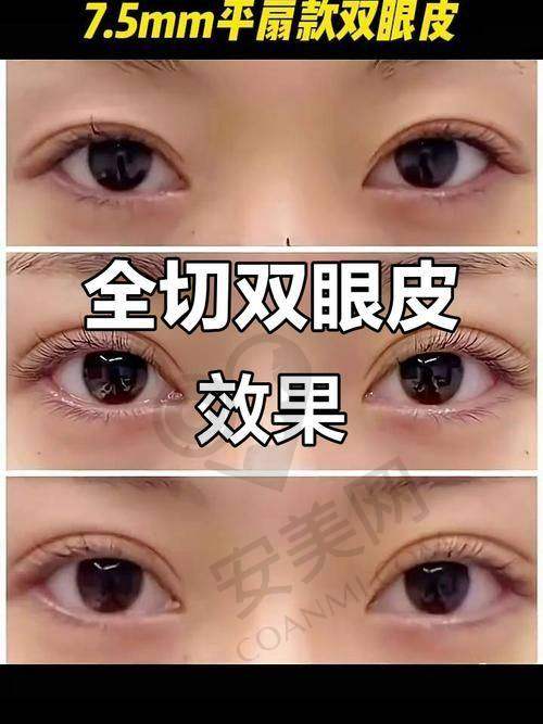 40000元以上：复杂修复阶段