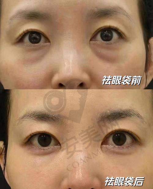 广州曙光美容医院的收费标准是怎样的？
