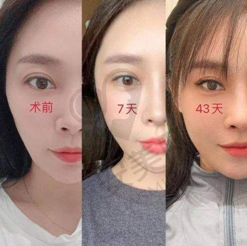 北京润美玉之光医疗美容的，价格是否合理？