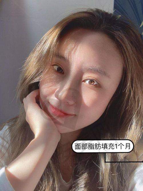 北京润美玉之光医疗美容的技术水平怎么样？
