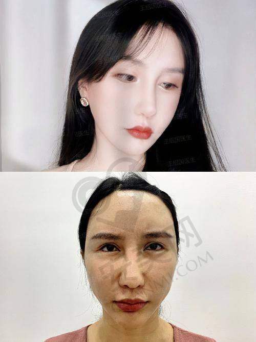 北京润美玉之光医疗美容在行业中的地位如何？