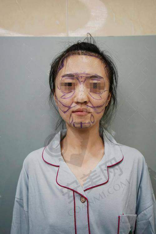 北京润美玉之光医疗美容的服务质量好不好？