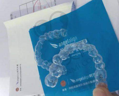 在杭州艺星口腔做时代天使隐形矫正有哪些保护？