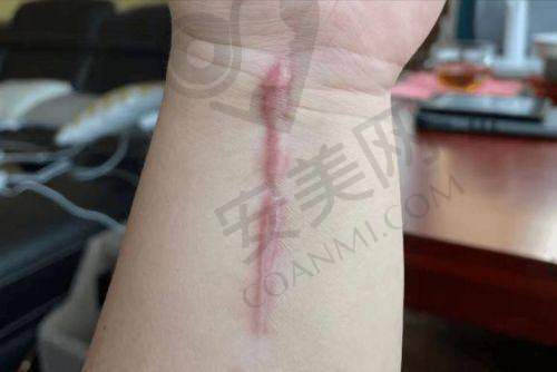 合肥煜美人整形：真实评价与对比照参考