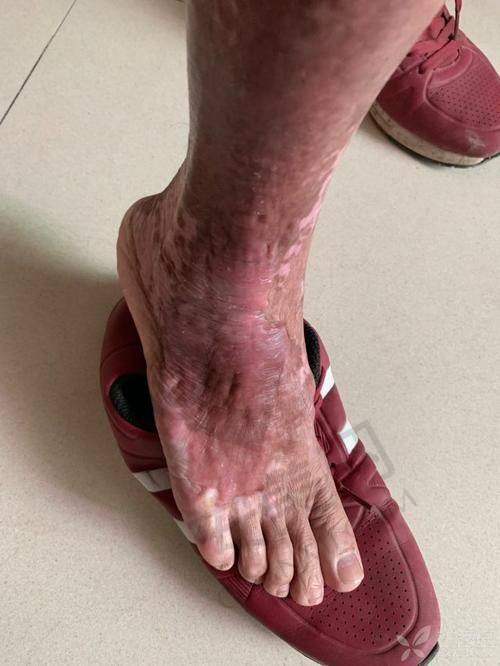 合肥智善美医疗美容：经验多医生分类治疗