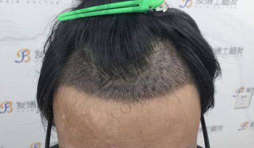 天津医莱新美思医疗美容门诊：专精打造青春方案