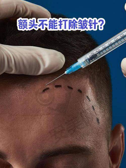深圳安美聚光的后续服务怎么样？