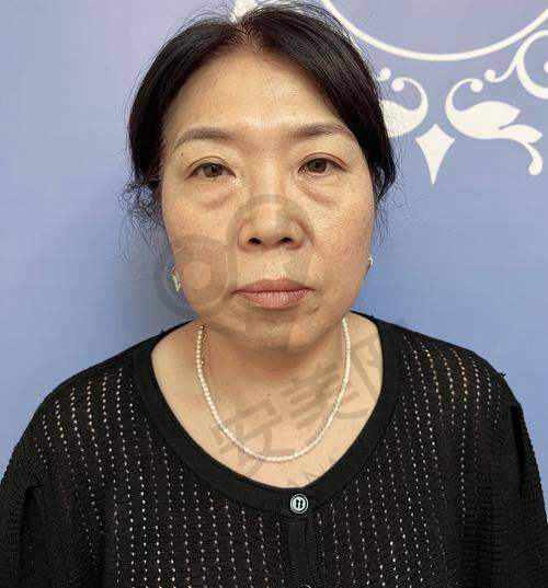 初次就诊：面诊与方案制定