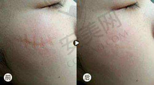 贵阳利美康外科医院——实力雄厚的连锁品牌