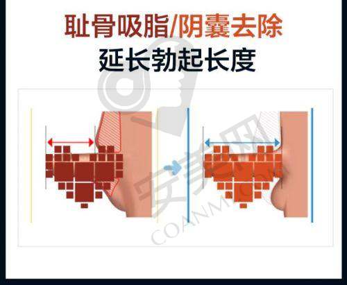 患者对北京煤医西坝河整形医院的好评