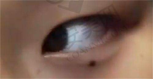 总结