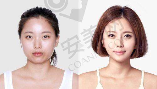 广州美莱整容医院地址林和西横路222号，服务质量如何？