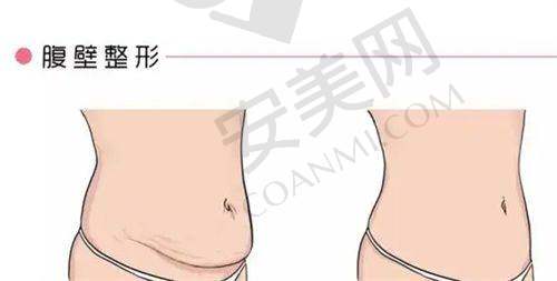 田秋梅医生做鼻子有哪些独特的技术？