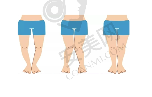 治疗过程是怎样的？会疼吗？