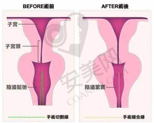 5、成都丝缘植发陈祖庆医生患者评价