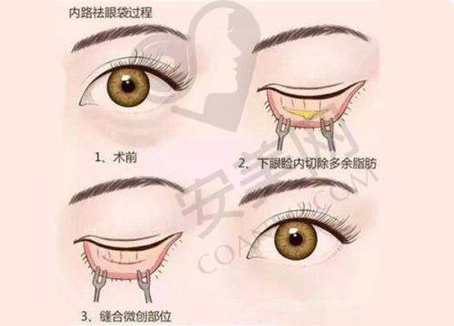 如何选择适合自己的医美机构
