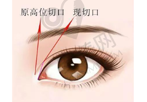 梅州曙光医疗美容医院患者评价：