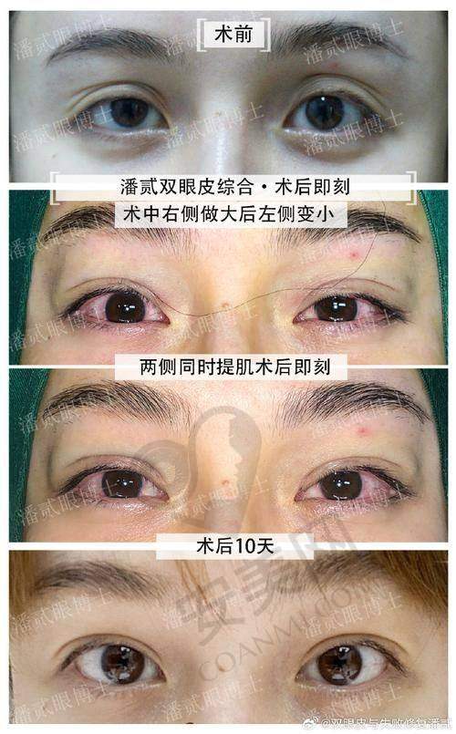 9800元起的眼整形项目：多样选择与价值体现