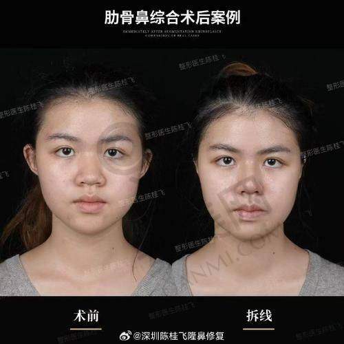 26800元起的价格优势与选择