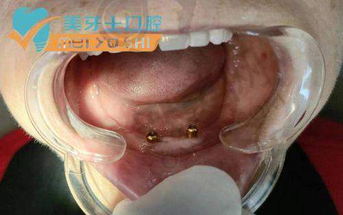 深圳正夫口腔医院是怎样的存在？